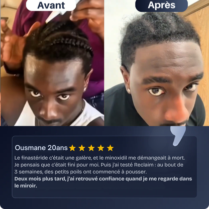 Reclaim – Sérum Repousse